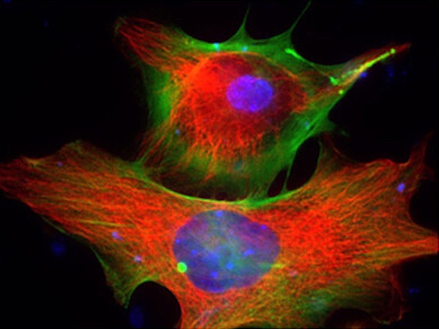 Dues estructures amb un cercle central de color morat.