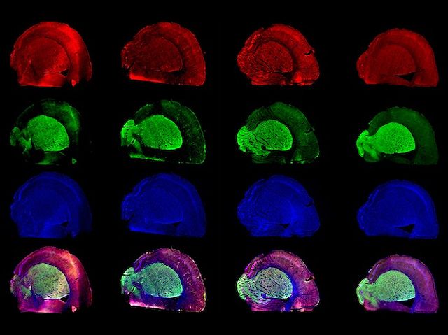 4 imatges semicirculars tenyides de roig, blau i verd (per separat), marcant zones diferents i 4 imatges sumant els 3 colors anteriors