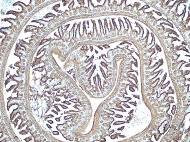 Replecs (part de l'intestí prim) que acaben en el centre de la pantalla amb petites ratlles que representarien les vellositats intestinals al voltant