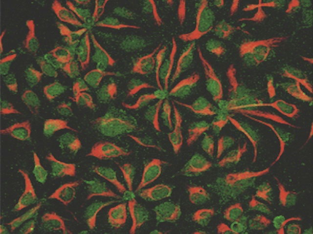 Formes paregudes a flors en inflorescència de capítol de color roig i verd