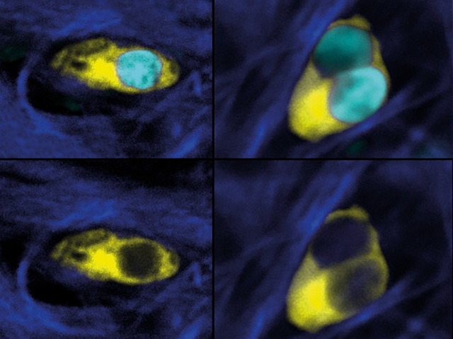 Tres mastòcits ovalats en groc, que tenen neutròfils també ovalats, en cian, dins d'ells.