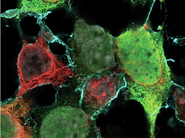 unes cèl·lules poligonals, unes es veuen verdoses i altres no