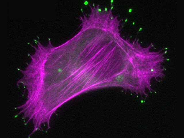 Massa filamentosa rosa amb punts verds a les puntes