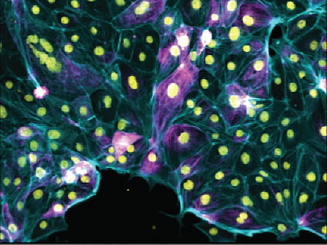 cèl·lules amb el contorn blau i amb forma irregular formant com un mosaic, la part interna és fosca i dins es veu un punt groc. Alguna cèl·lula té la part interna fúcsia.