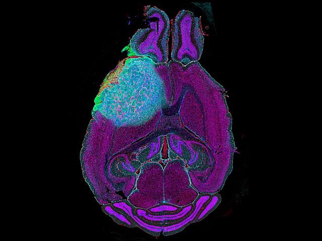 una secció ovalada (el cervell) de color morat i, en una zona concreta, de color blau