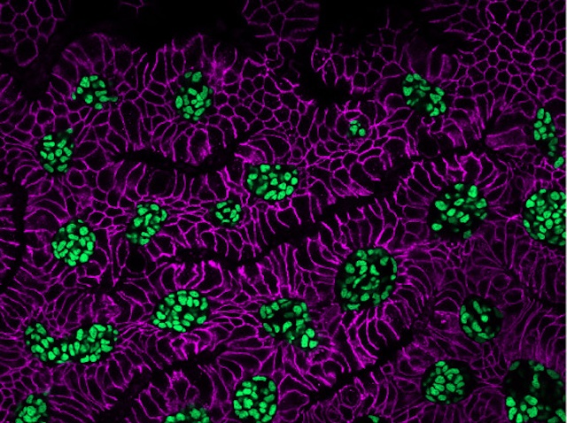 cèl·lules arrodonides juntes, amb el citoplasma ple de línies fúcsia i el nucli amb punts verds