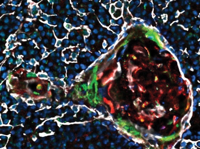 Estructura cilíndrica amb vista transversal i longitudinal embeguda en una xarxa d'estructures redones blaves. L'interior del cilindre conté feixos de color roig i al seu exterior s'observa una capa verda.
