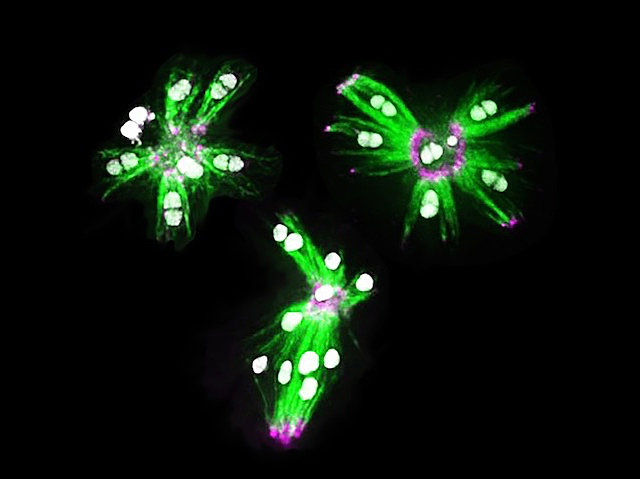 Tres estructures semblants, amb un centre morat d’on es prolonguen filaments dobles de color verd. Entre cada parell de filaments s’observen uns cercles irregulars blancs.