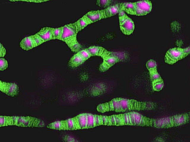 es veuen mitocondris com tubs grossos amb línies verdes transversals i taques rosa