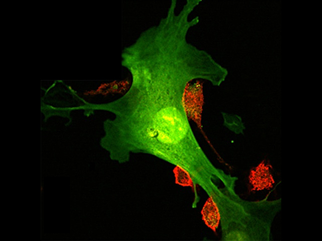 una cèl·lula verda estirada i 5 roges, redones, pel costat