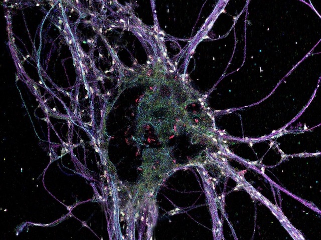 una neurona, més o menys circular, amb una regió verda i punts rojos, i amb filaments violacis que ixen o passen prop de la neurona