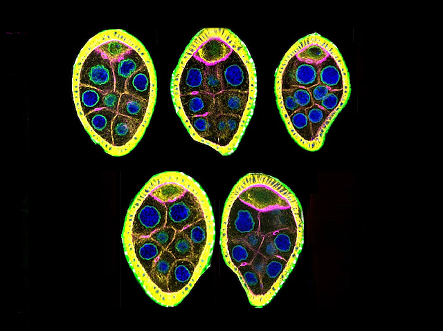 5 formes ovalades amb una vora de color groc i l'interior amb cercles més menuts de color blau. Cada òval té una diferent composició de cercles blaus al seu interior.
