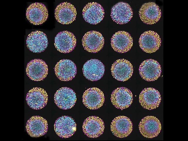 25 cercles amb diferents composicions de punts de diferents colors (morat, blau i groc) al seu interior.