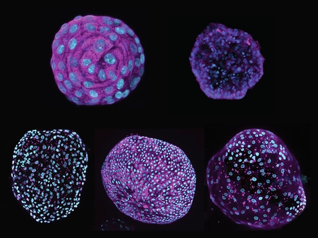 5 seccions circulars d'organoides de color fúcsia i els nuclis cel·lulars en blau