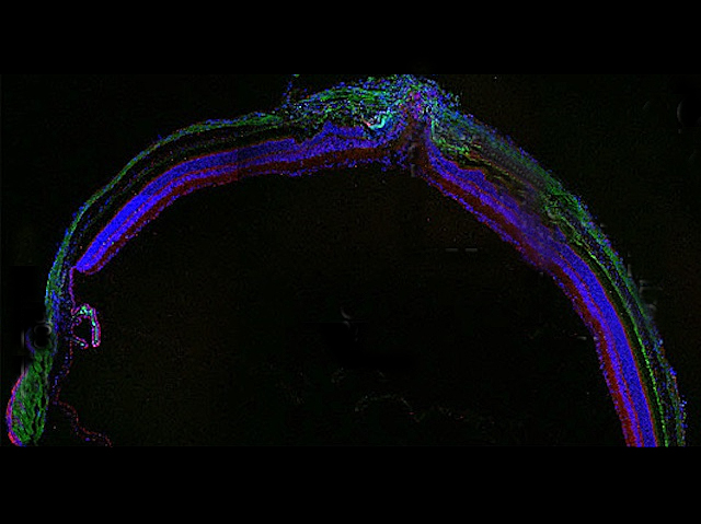 Secció incompleta de la part posterior de l'ull, amb forma d'arc. La retina es veu de color blau amb els nuclis rojos i les capes externes de l'ull de color verdós