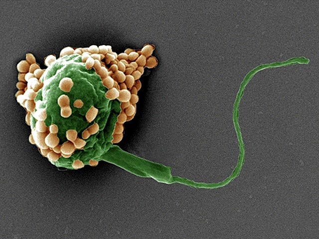 una esfera verda que té un filament. Sobre ella unes quantes partícules de color carabassa
