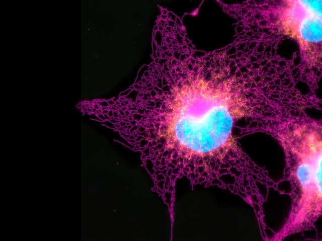 unes cèl·lules brillants de color magenta amb més lluentor de color taronja la zona pròxima al nucli (que és de color blau)