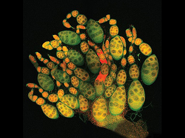 un conjunt d'estructures ovalades, de diferent tamany, de color ataronjat i cercles obscurs al seu interior