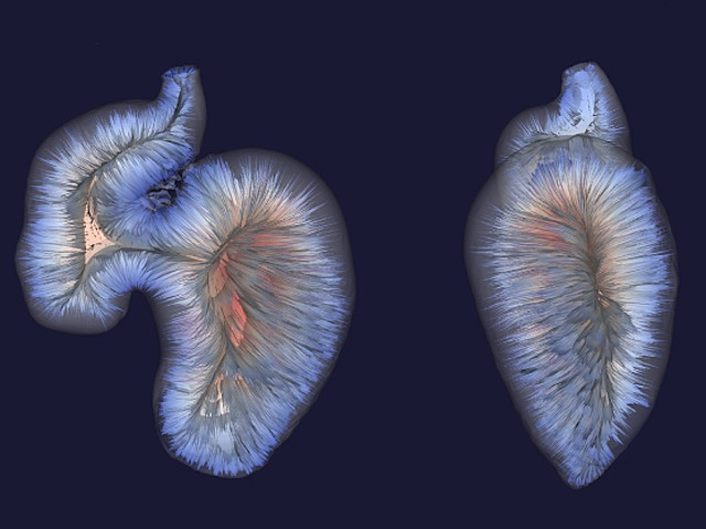 Imatges del cor en desenvolupament d'un peix zebra, són com uns fils allargats de color blau clar que sorgeixen d'una mateixa àrea central.