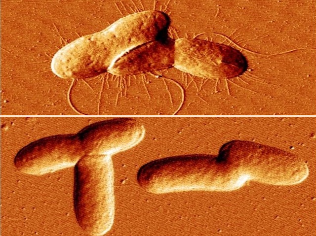 Bacteris amb i sense fímbries, degut a la presència del metabolit MEcPP