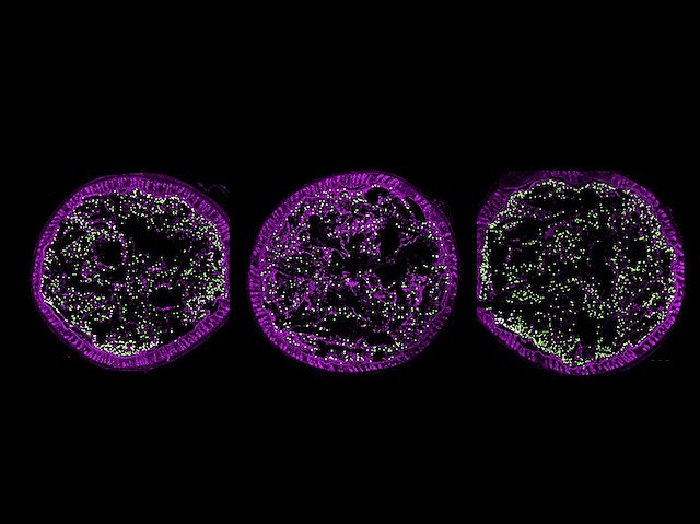 Bacteris E.coli uropatògens a l'intestí humà