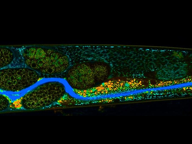 Imatge de microscòpia de fluorescència de l'intestí d'un nemàtode amb larva marcada amb color blau.