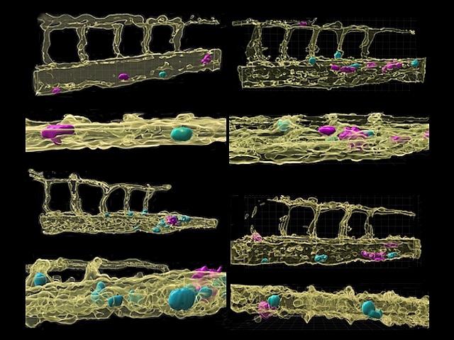 Imatge de cèl·lules tumorals i ions de Calci a l'interior dels vasos sanguinis