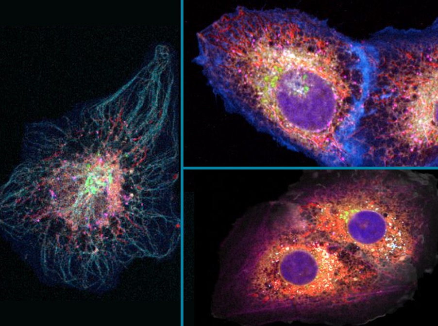 Imatge del citoesquelet cel·lular i de cèl:lules canceroses d'os que tenen diferents parts marcades amb colors