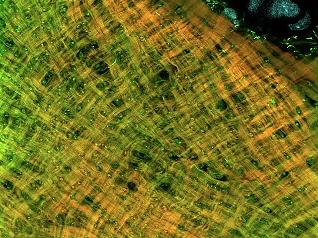Estructura formada per filaments horitzontals i verticals amb tonalitats grogues i verdes. S’observen uns punts xicotets de color verd fluorescent entre els filaments.