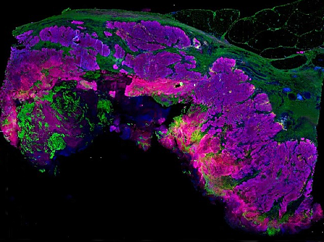 Una imatge microscòpica que mostra una estructura corbada amb textures irregulars, il·luminada en tons de morat, verd i rosa fluorescent sobre un fons negre.