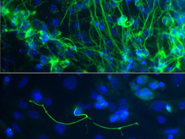 Producció d'una proteïna marcador neuronal(verd) només en presència de KAT6B