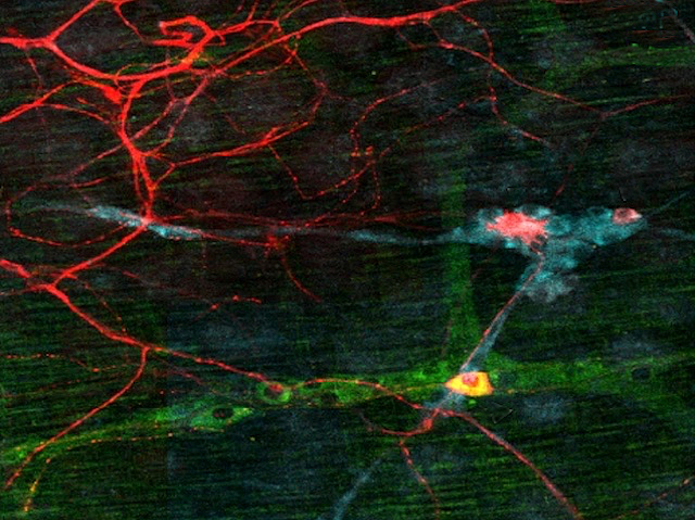 A la part superior s’observen ramificacions fines de color roig mentre que a la part inferior es troba una línia més gruixuda i molt menys ramificada, de color verd.