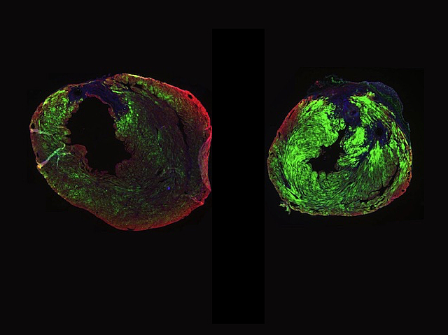 Dues siluetes de forma redona irregular amb un centre negre també irregular. Sembla un tall transversal. El perímetre té tonalitats rogenques mentre que l’interior és verd fluorescent. En la silueta de la dreta s’observa una regió major de color verd.