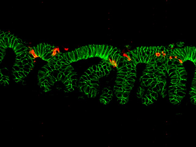Imatge de microscòpia ressaltant en roig els bacteris atrapats i en verd en una estructura allargada destacada en verd