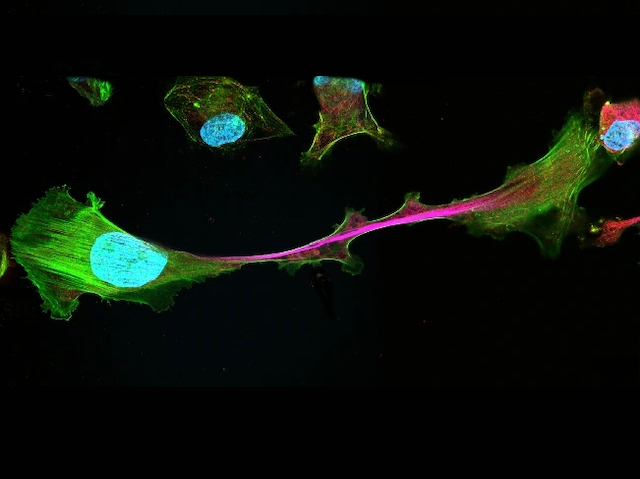 Imatge de microscòpia amb dues cèl·lules connectades per una estructura interna marcada de color rosa