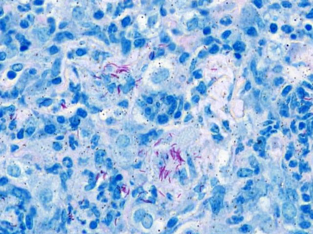 Tall amb cèl·lules animals en blau entre les quals es distingeixen bacteris amb forma de bastonet rosa