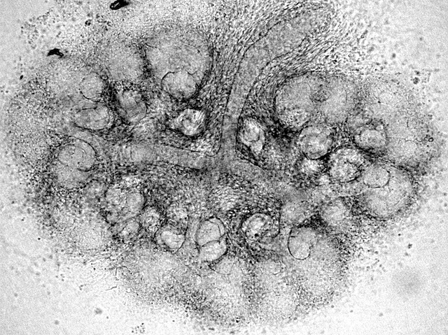 Cèl·lules renals en blanc i negre