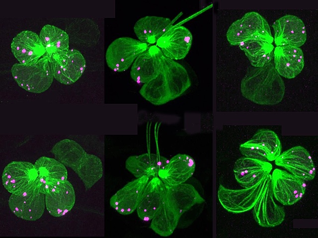 Cèl·lules ciliades senyalitzades en verd en teixits, amb algunes zones marcades en rosa, els llaços