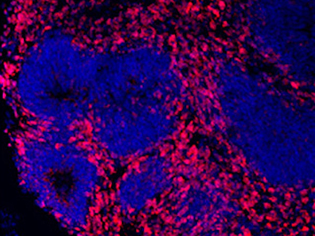 Organoide cerebral amb neurones pintades en roig, i altres teixits en morat