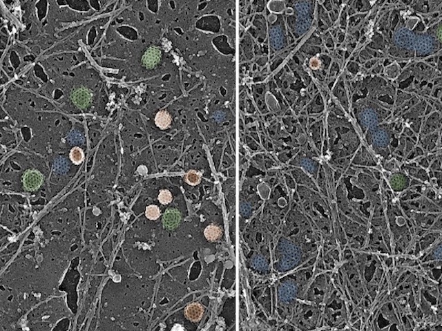 Dos conjunts de xarxes iguals separats per una línia en el centre sent la part de la dreta la que té més xarxes i cercles pareguts a la constitució dels ulls compostos d'una mosca