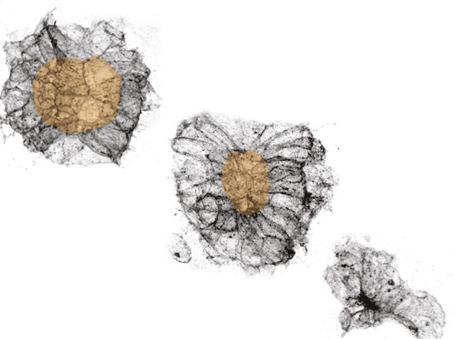 3 estructures disposades en diagonal, d'esquerra a dreta, la primera té forma arredonida amb el centre marró, en la central aquest centre marró és molt més menut i el perímetre més ample, la seua forma no és tan circular i, finalment, a la dreta, es pot veure l'estructura plegada o doblegada, on el centre ha desaparegut.