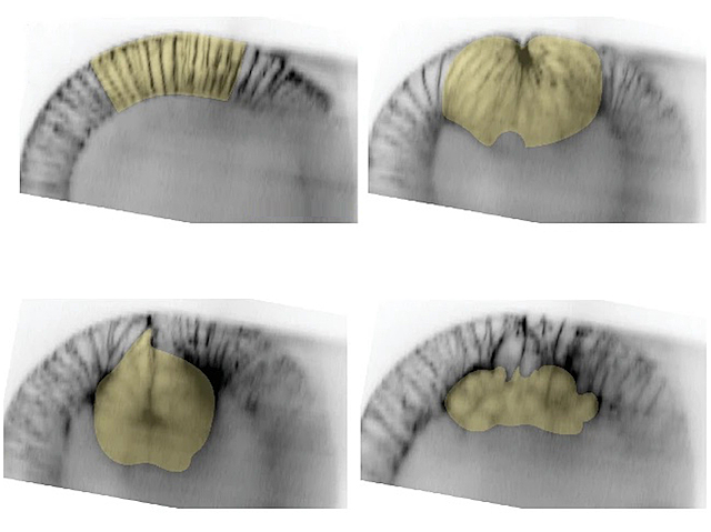 4 imatges d'un teixit gris que té superposat una zona groga superficial que es plega i acaba a l'interior