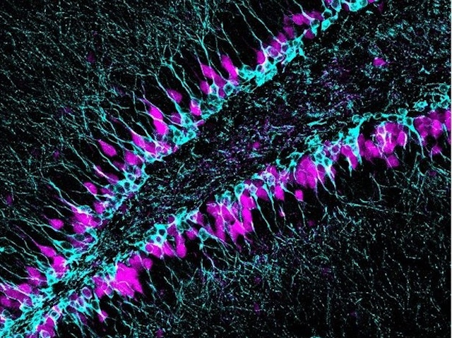 una barreja de cèl·lules fúcsia i blaves que descriuen una V