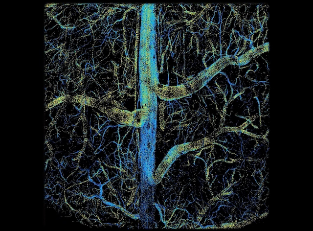 un conducte cilíndric vertical, de color blau i groc, amb multiples ramificacions cap als costats
