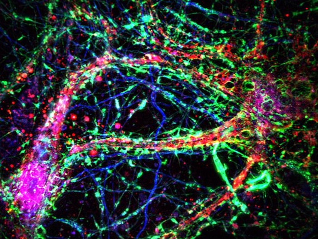 Preparació fluorescent amb prolongacions neuronals marcades en roig envoltades per fibres verdes.
