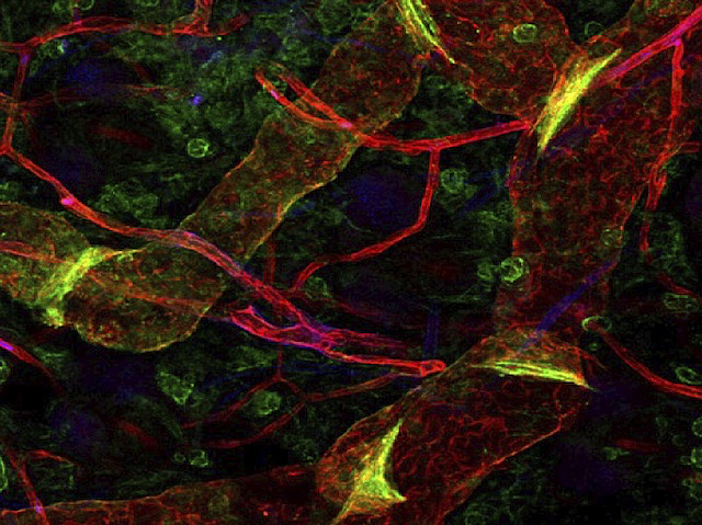 Estructures en tres dimensions marcats en roig amb fluorescència de diferents mides amb estructures en groc a dins similars a tabics