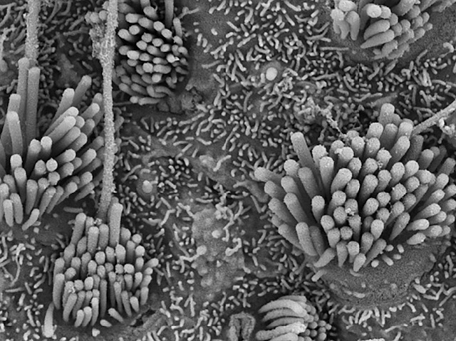 Imatge a microscopia electrònica on es veuen agrupacions de cilis, alguns visiblement desorganitzats, sobre una superfície.