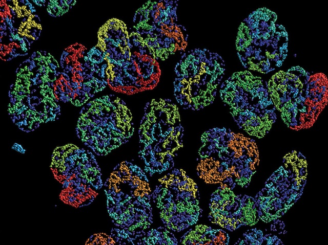 neutròfils marcats amb fluorescència i que es veu com filaments de diferents colors