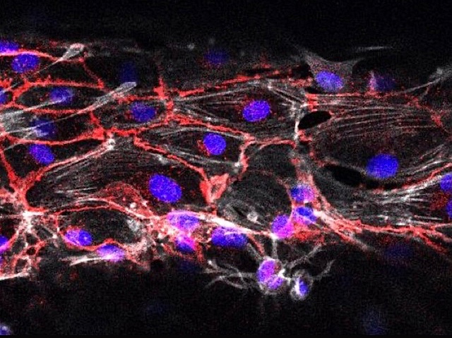 un conjunt fibres fluorescents entre les quals es veuen nuclis blaus