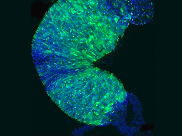 un fragment d'intestí marcat amb fluorescència, amb colors verd i blau